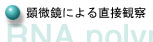 顕微鏡による直接観察へ