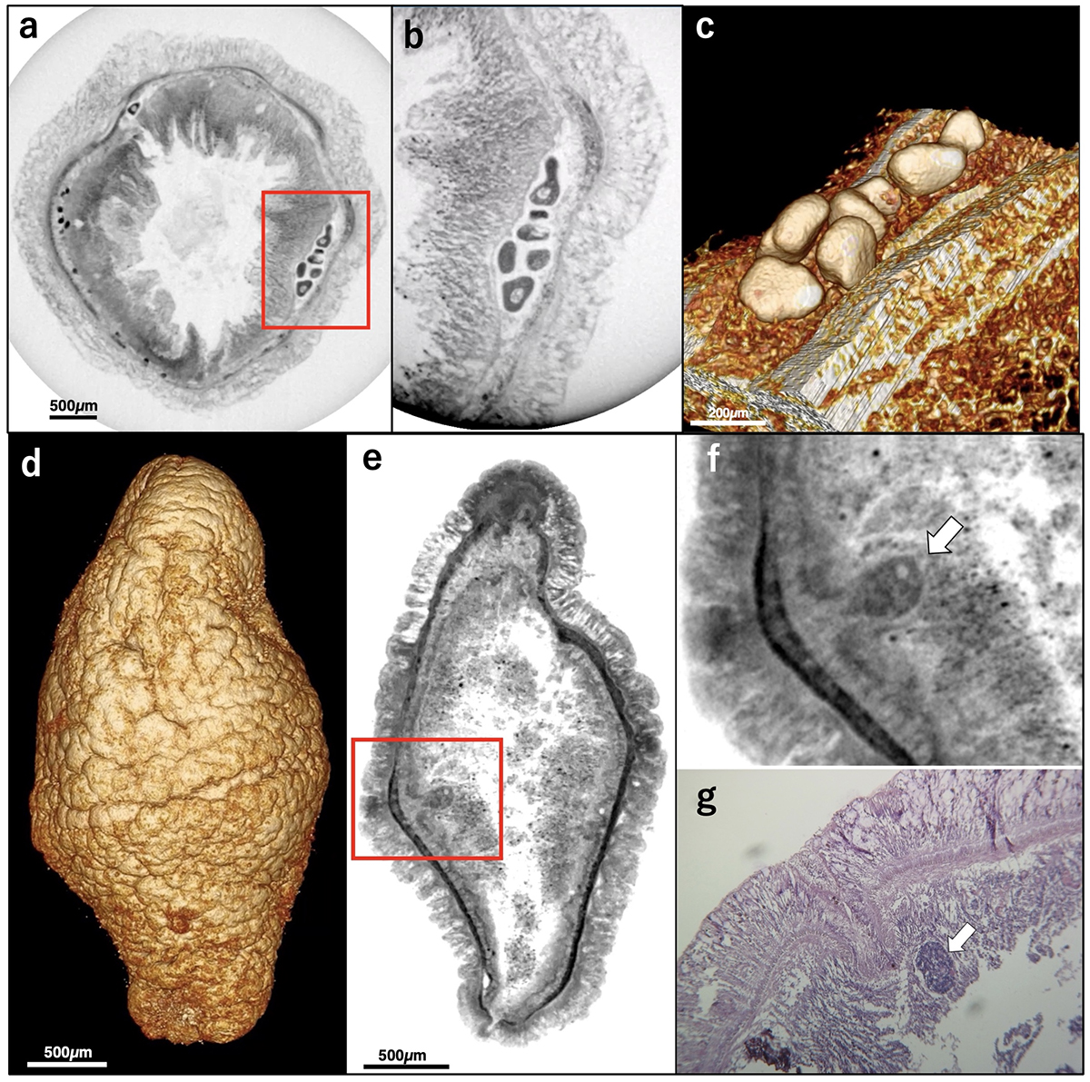 Figure1