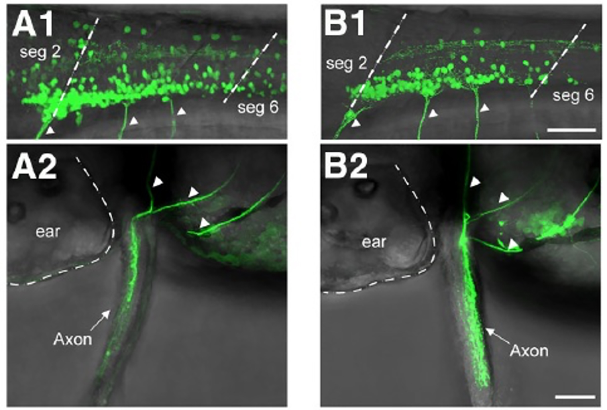 Figure1